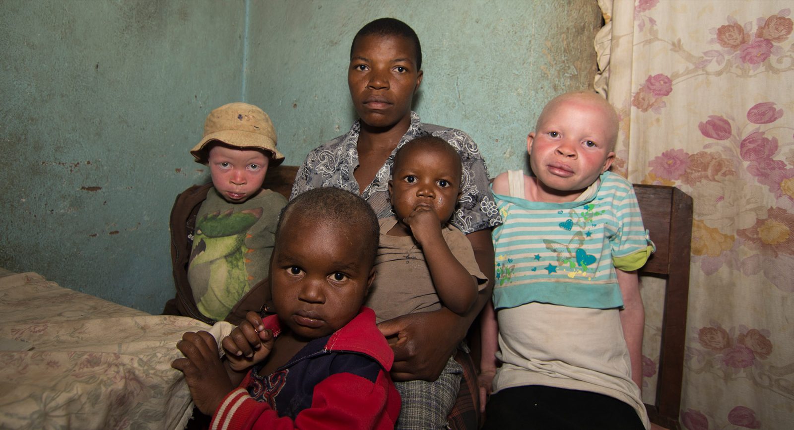 A family in Malawi with one Albino child