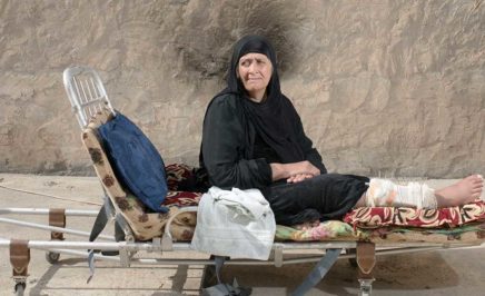 West Mosul image of a woman with a bandage on her leg
